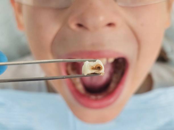 Best Emergency Gum Treatment in Red Wing, MN